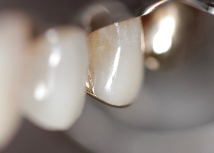 Mark Chun #13 MB view