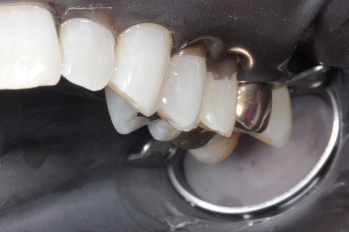 Mark Chun #13 pre-op 