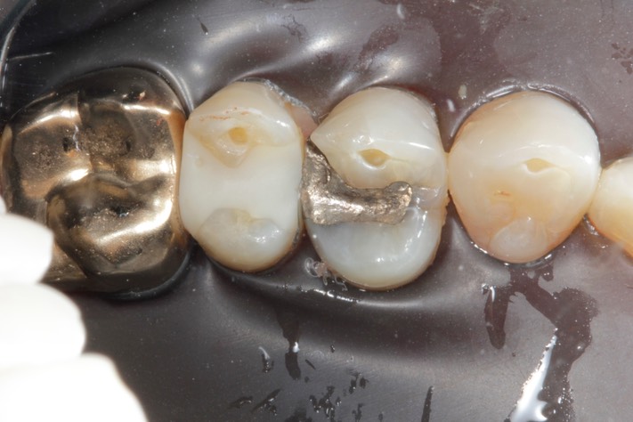 Mark Chun #13 pre-op