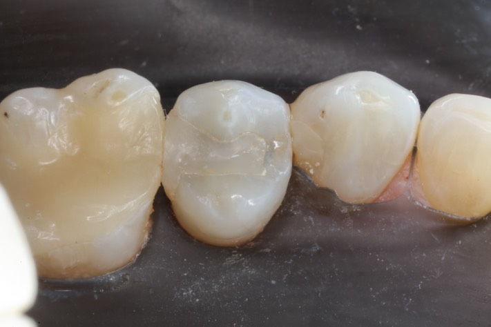 Mark Chun #13 pre-op