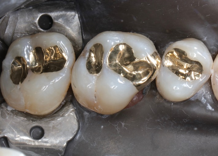 Mark Chun #13,14,15 finish