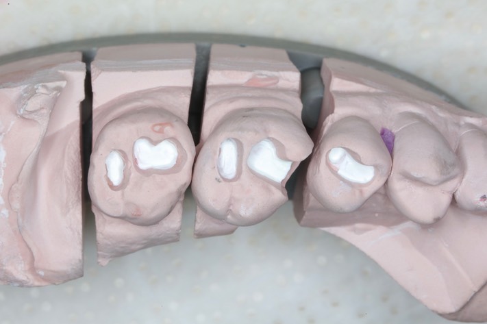 Mark Chun #13,14,15 model