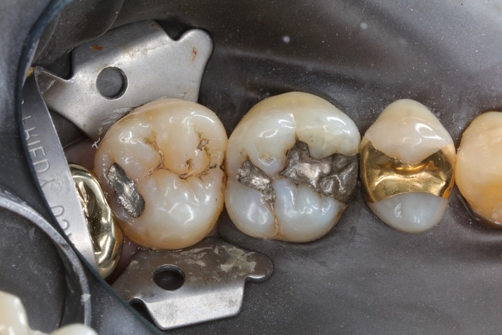 Mark Chun #14-15 pre-op