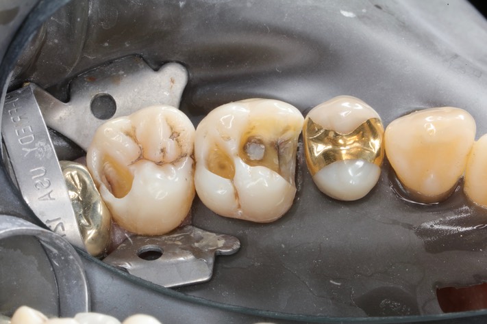 Mark Chun #14-15 prep