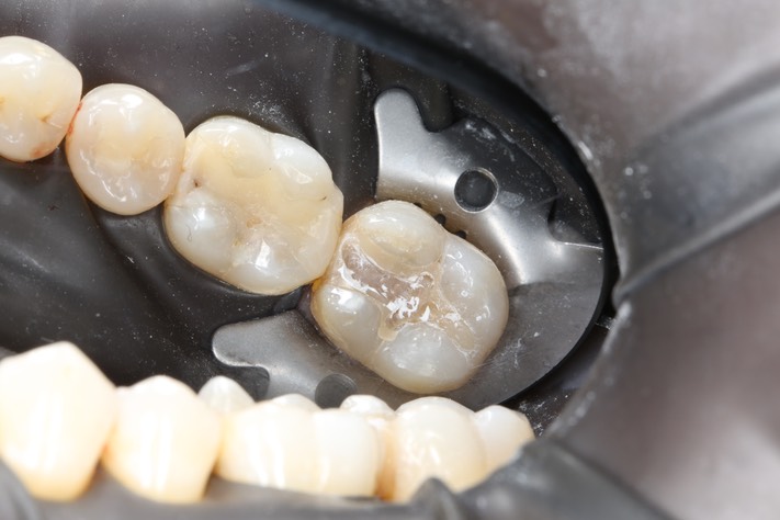 Mark Chun #18 pre-op