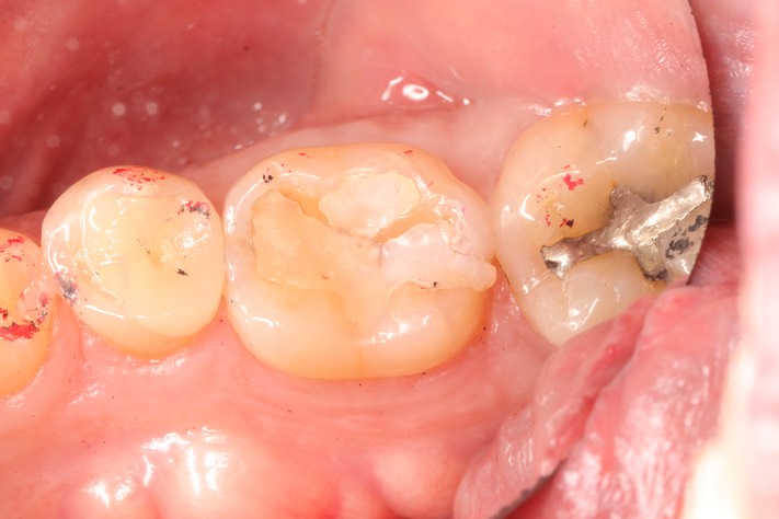 Mark Chun #19 pre-op