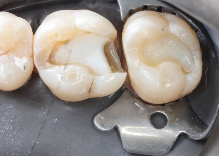 Mark Chun #2 & 3 prep