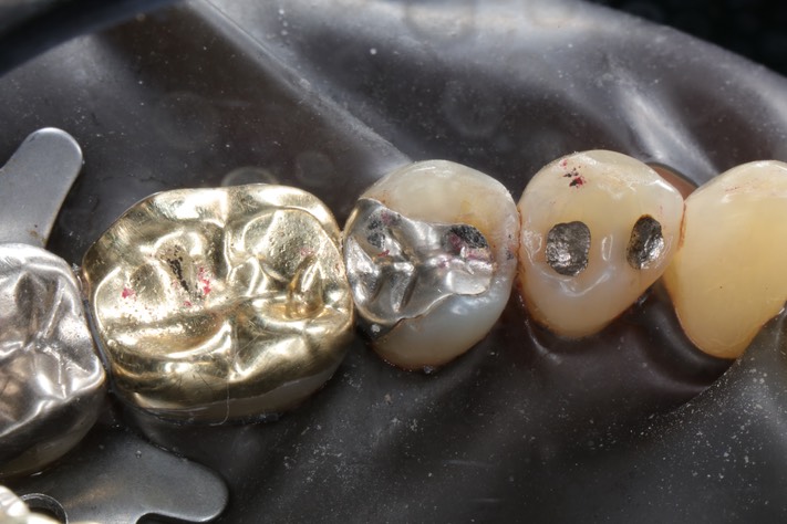 Mark Chun #29 pre-op