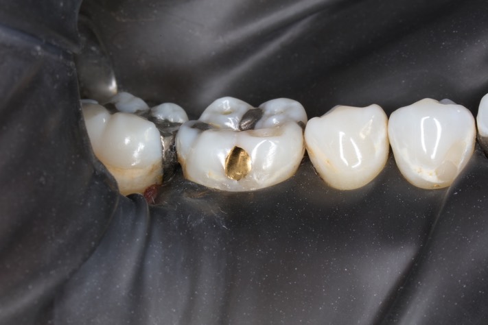 Mark Chun #30 finish