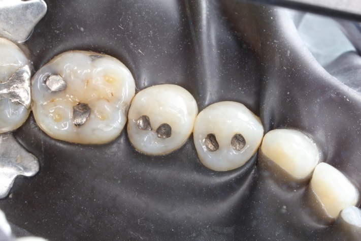 Mark Chun #30 pre-op