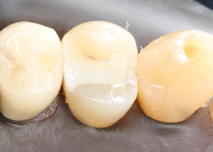 Matt Dodson #12 pre-op