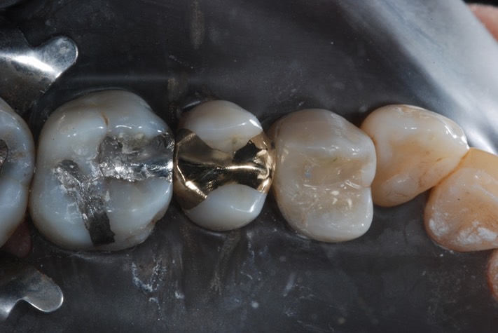 Matt Dodson #13 finish