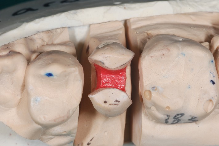 Matt Dodson #13 model