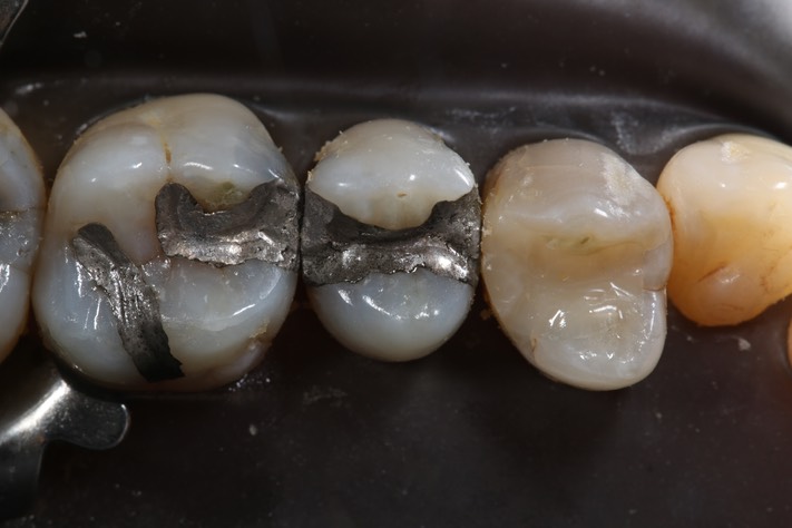 Matt Dodson #13 pre-op