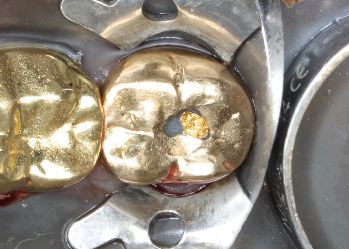 Matt Dodson #18 pre-op