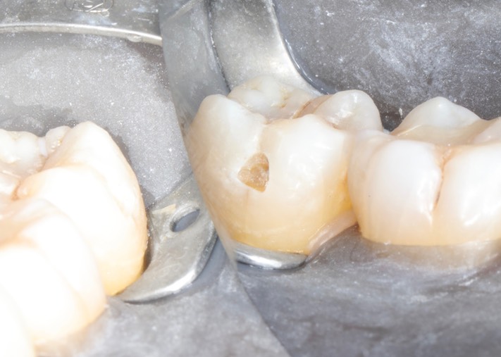 Matt Dodson #18 prep