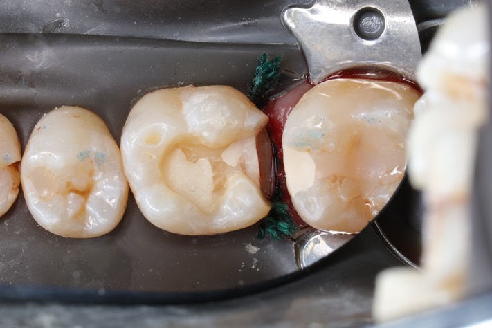 Matt Dodson #19 prep