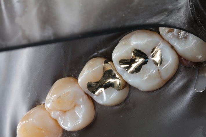 Matt Dodson #2-3 finish