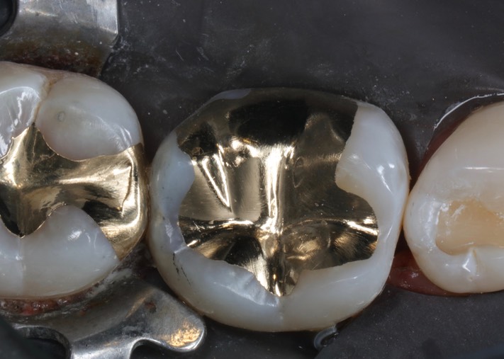 Matt Dodson #30 finish