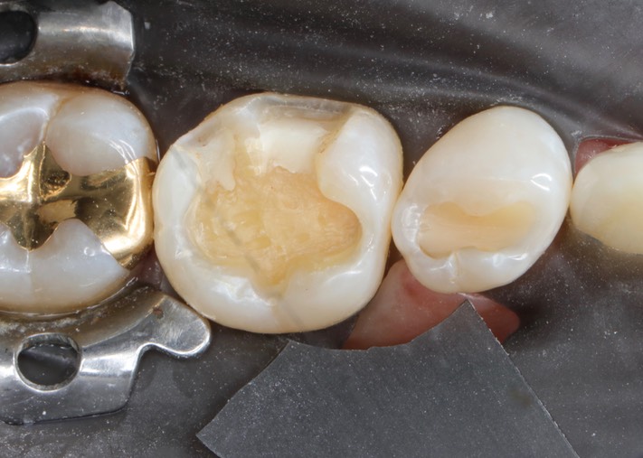 Matt Dodson #30 prep