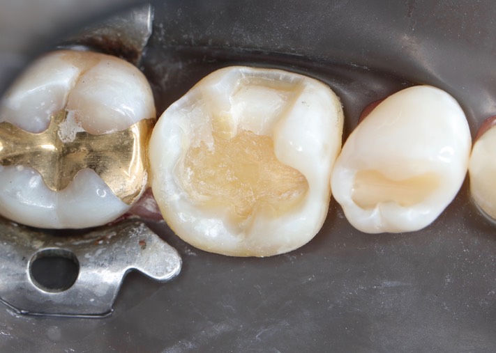 Matt Dodson #30 prep