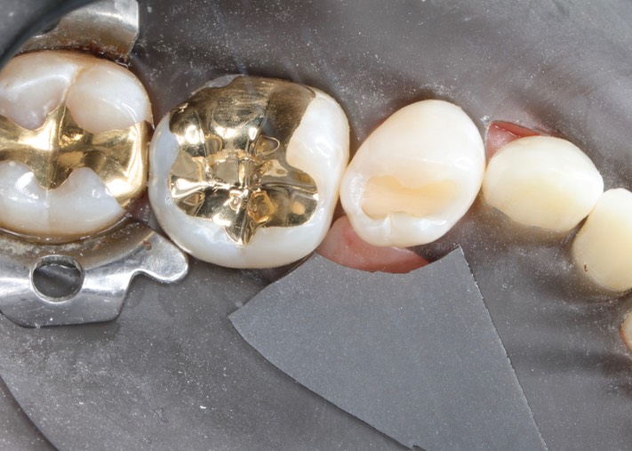 Matt Dodson #30 try in