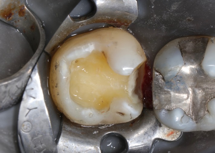 Matt Dodson #31 prep