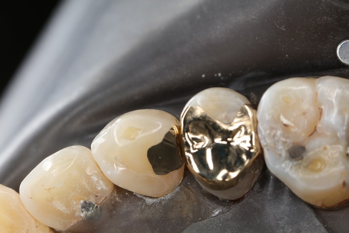 Matt Dodson #5-6 finish