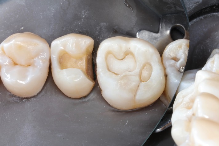 Matt Dodson#3-4 prep