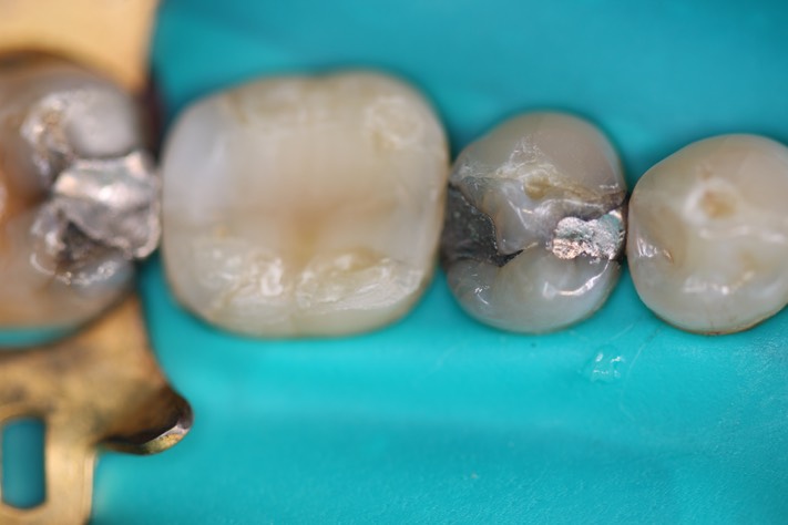 MItchell Chun #29 pre-op