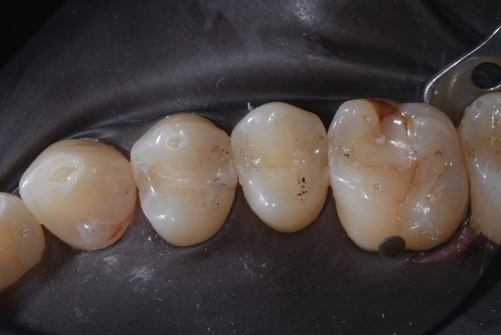 Nina Hayashi #4 pre-op