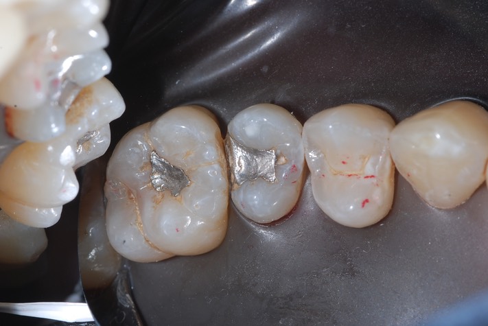 Roland Ylarde #13 pre-op