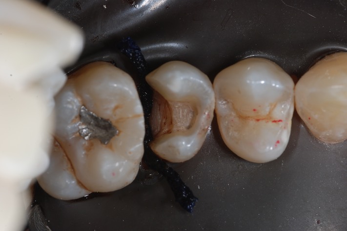 Roland Ylarde #13 prep