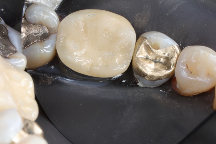 Russ Tabata #20 pre-op