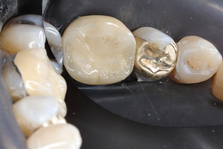 Russ Tabata #20 prep