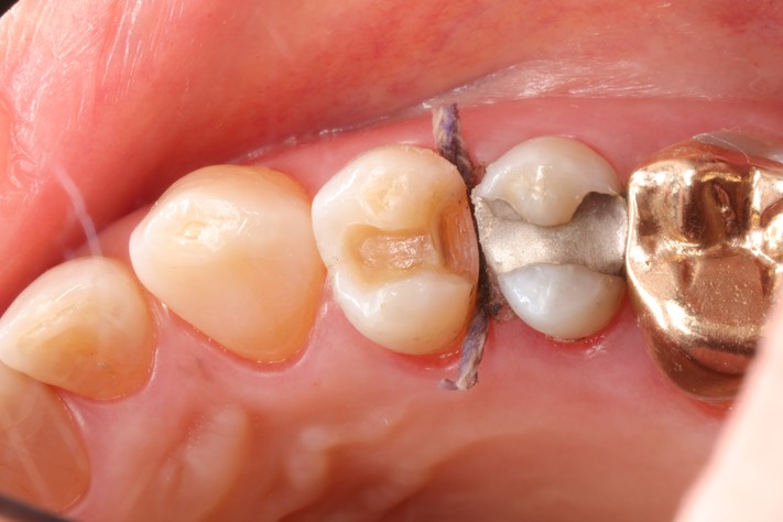 Russ Tabata #5 finish