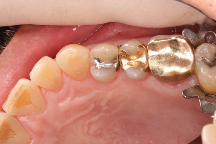 Russ Tabata #5 pre-op