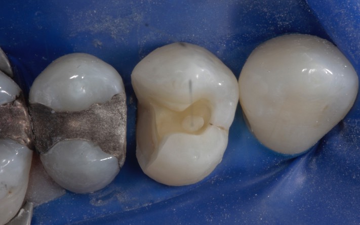 Scott Kanamori #12 prep