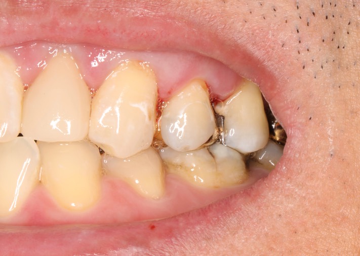 Scott Kanamori #12 smile