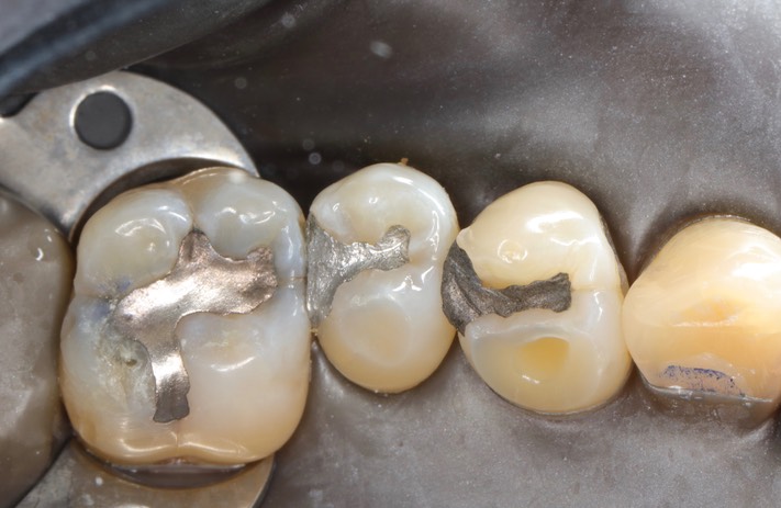 Scott Kanamori #13 pre-op