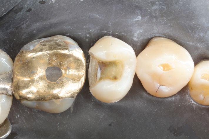 Scott Kanamori #13 prep