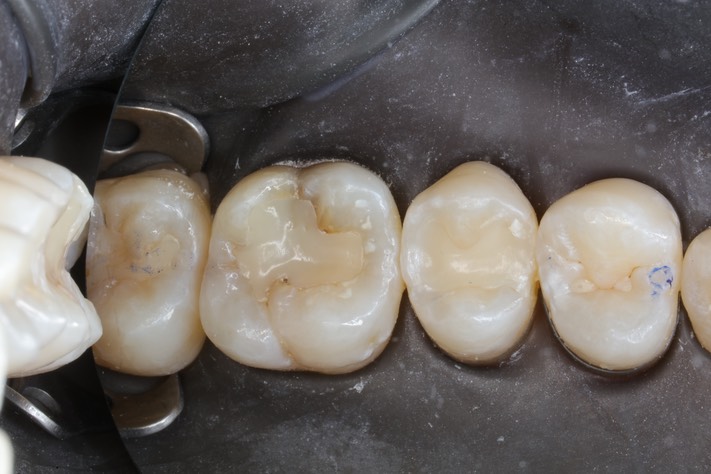 Scott Kanamori #14 pre-op