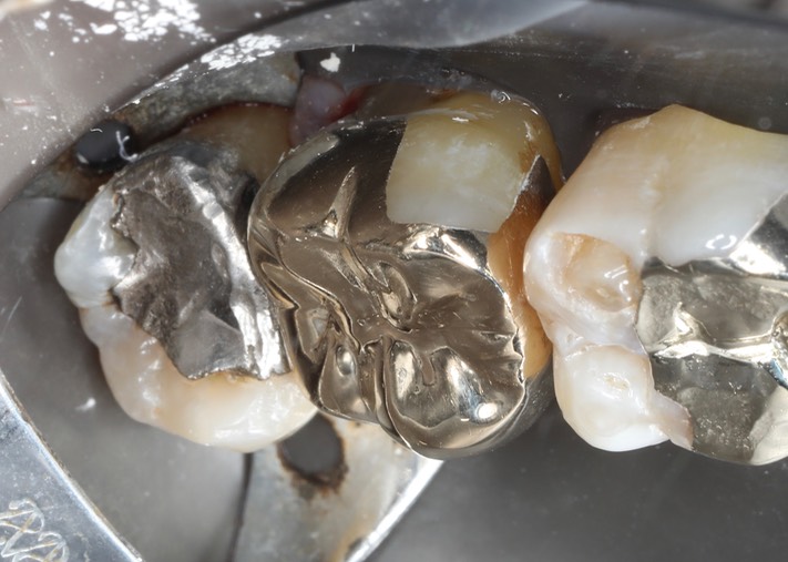 Scott Kanamori #15 buccal view