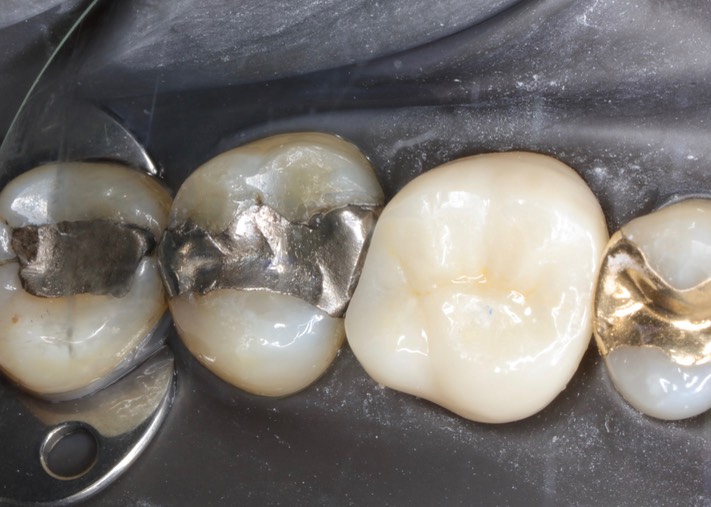 Scott Kanamori #15 pre-op