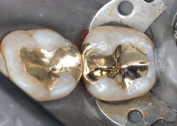 Scott Kanamori #18 finish