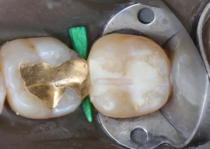 Scott Kanamori #18 pre-op