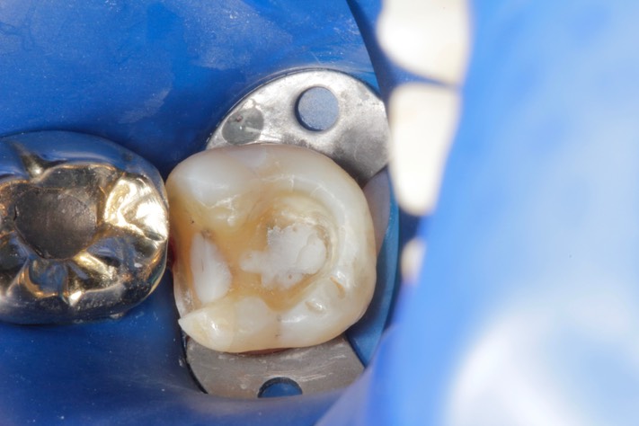 Scott Kanamori #18 prep