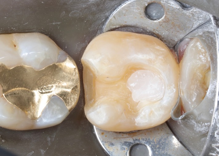 Scott Kanamori #18 prep