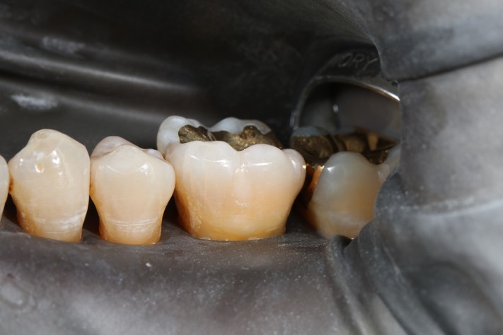 Scott Kanamori #19 F pre-op