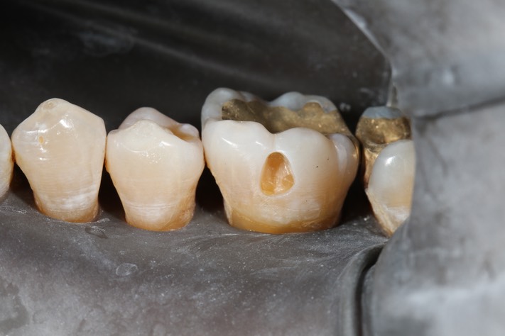 Scott Kanamori #19 prep